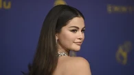 Selena Gomez Mengidap Artritis akibat Penyakit Lupus yang Dideritanya, Buka Tutup Botol pu...