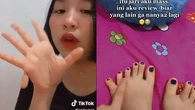 Kenali Penyebab dan Cara Menangani Polidaktili, Ketika Jari Tangan atau Kaki Lebih dari 10