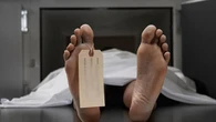 Warga Minahasa Utara Meninggal Dunia Saat Duduk di Teras Rumah