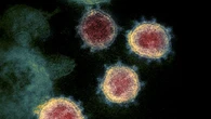 Cek Fakta: Tidak Benar Pasien di RS Akibat Influenza A Diisolasi Seperti Covid-19