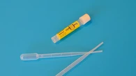 Teka-Teki 150 Tahun Kenapa Urine Berwarna Kuning Akhirnya Terpecahkan