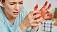 8 Cara Meredakan Rasa Panas dan Terbakar di Tangan Akibat Cabai dengan Aman