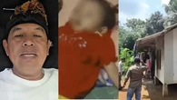 Ibu Alami Disabilitas Mental, Bocah Sukabumi dengan Penyakit Cacingan Semasa Hidup Sering ...