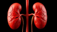 Glomerulonephritis, Penyebab Gagal Ginjal yang Tak Pandang Usia