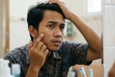 Apakah Bruntusan Bisa Hilang Sendiri? Ini Penjelasan dan Faktanya