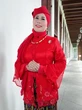 Mata Kanan Penyanyi Dewi Yull Buta Gegara Ablasi Retina, Kondisi Apa Itu?