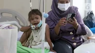 Pasien Thalasemia Mayor Bisa Bebas dari Transfusi Seumur Hidup dengan Transplantasi Sel Da...