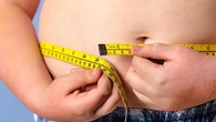 UNICEF: Jumlah Anak Obesitas Kini Lebih Banyak dari Berat Badan Kurang