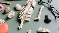 Achondroplasia, Penyakit Langka yang Mengganggu Pertumbuhan Tulang
