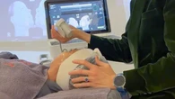 Teknologi UltheraPrime, Cara Remajakan Wajah Tanpa Bedah
