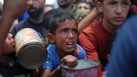 Krisis Gizi di Gaza, Dosen Unair: Bentuk Nyata Dunia Gagal Lindungi Hak Dasar Anak