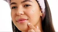 Bye Jerawat Meradang, Ini Acne Patch Terbaik yang Lagi Banyak Dicari