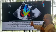 Sama-Sama Cek Kondisi Jantung, Ketahui Perbedaan EKG dan Ekokardiografi
