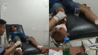 Dibacok Tetangga, Pria di Lampung Alami Luka Sekujur Tubuh