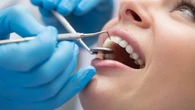Vítimas de violência terão reconstrução dentária no Amapá