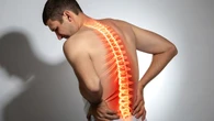 Dor nas costas pode ter origem no cérebro, alerta médico