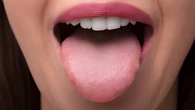 O lugar mais sujo da boca não é o dente