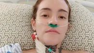 Após 6 cirurgias, jovem com 'pior dor do mundo' entrará em coma