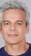 Aneurisma: veja o que é a doença de Otaviano Costa