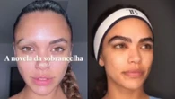 Giovana Cordeiro passa por transplante de sobrancelha: "Calva"