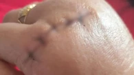 Aluna de 14 anos ataca professora com facadas em escola no RS