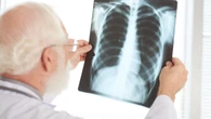 Pneumonia silenciosa: o perigo por trás da doença "escondida"