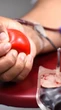 Campanhas da saúde em junho alertam para melanoma, anemia, leucemia e doações de sangue