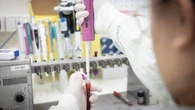 Saúde investiga novo caso suspeito de Ebola em São Paulo
