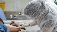 Implante contraceptivo que dura até 3 anos chega ao SUS