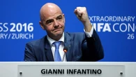 FIFA arrecada bilhões na Copa e campeão fica com "migalha"; veja