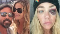 Atriz norte-americana acusa ex-marido de agressões; veja