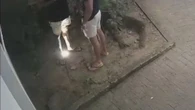 Ambulante baleado em Noronha terá perna amputada