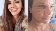 Mulher espancada com 61 socos mostra o rosto após cirurgias