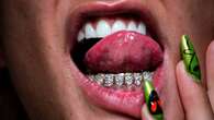 Grillz
dentais: joias para os dentes que vem conquistando as
celebridades