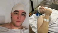 Influencer “guarda” osso da cabeça na barriga após acidente; entenda