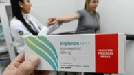 Planos de saúde passam a cobrir implante contraceptivo