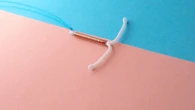 SUS aprova DIU hormonal para tratar endometriose