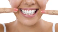 Afinal, as lentes de contato dental causam mau hálito?