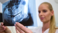 Harmonização orofacial: onde começa a estética?