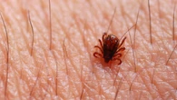 Minas registra quatro mortes por febre maculosa em 2025
