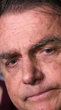 Exame detecta esofagite intensa e gastrite em Bolsonaro, que seguirá afastado em julho