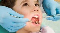 Odontopediatria moderna: cuidar dos dentes de leite é necessário?