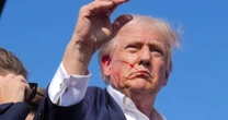 Trump says he was "pierced the upper part of my right ear" at rally