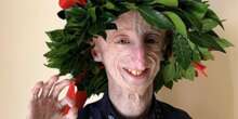 È morto a 28 anni Sammy Basso, affetto da progeria e molto noto per l’attività di divulgazione sulla sua malattia