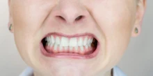 Bruxism adalah Kebiasaan yang Bisa Muncul Tanpa Sengaja Akibat Stres