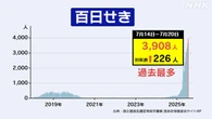 百日せき流行続く 患者数 5週連続の過去最多