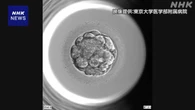 不妊治療 AIで卵子の数など予測するモデルを開発 東大など
