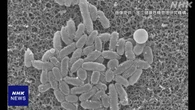 百日せき 全国で乳児4人死亡 “ワクチン接種 家庭での対策を”