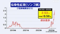 リンゴ病 1週間の患者数が過去最多 1医療機関当たり2.53人