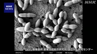 がん治療薬の効果高める腸内細菌を発見 マウスでの実験成功